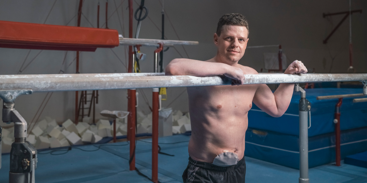 What Is A Stoma Is It Reversible? Cha Surgery